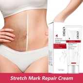 https://www.dagdoom.com.bd/Eelhoe stretch mark repair cream